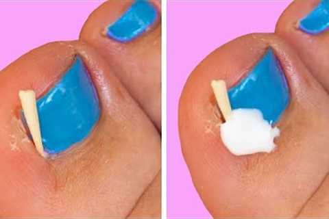 OH NOO! 😬 First Aid Tips and Safety Tricks For Common Problems