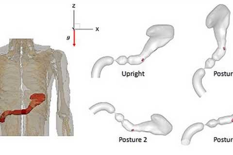 Body posture affects how oral drugs absorbed by stomach