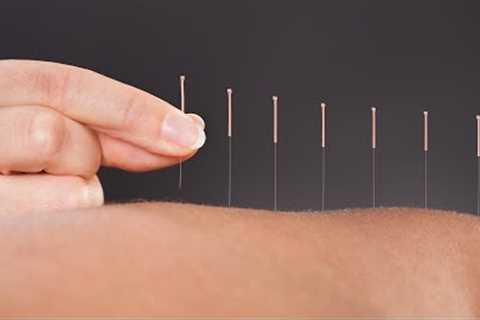 The Science Behind How Acupuncture Helps Relieve Pain: A Doctor Of Chinese Medicine Explains