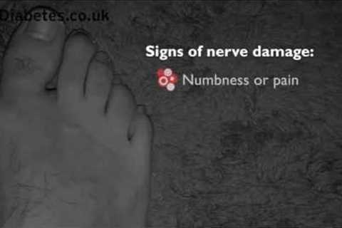 Checking Your Feet For Signs of Nerve Damage