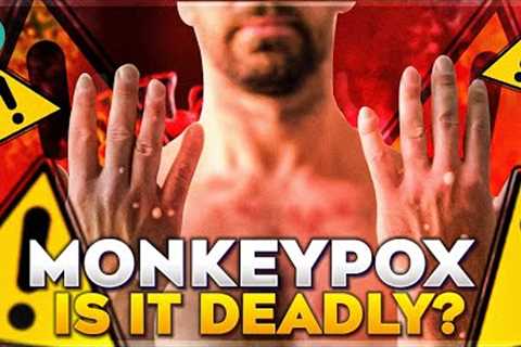 Monkeypox Causes and Symptoms| Health Hacks Infinity