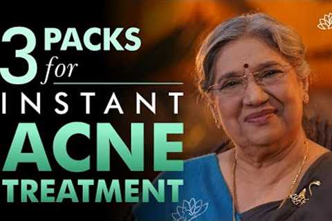 3 Best Face Pack for Acne Treatment Naturally | Home Remedies for Acne | How to Get Rid of Acne