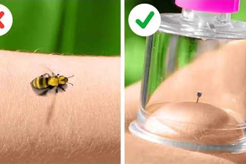 FIRST AID HACKS || Simple Solutions For Common Troubles
