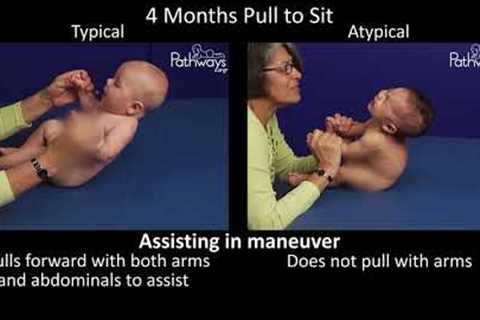 4 Month Old Baby Typical &amp; Atypical Development Side by Side