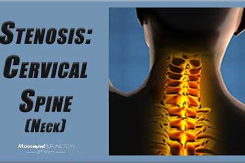 Cervical Spine Stenosis | Best Exercises to Decrease Pain (and Other Symptoms)