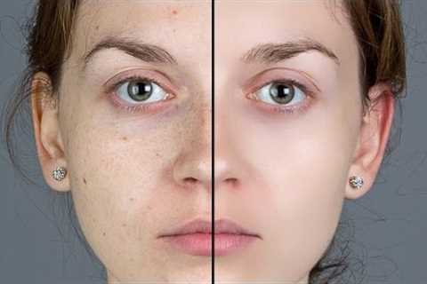 Photoshop Tutorial: How to Quickly Smooth Skin and Remove Blemishes &amp; Scars