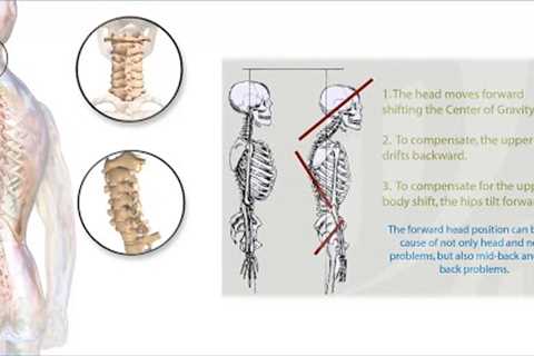 What a pain in the neck!