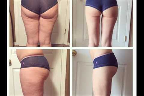 VLOG: My Cellulite is GONE!! Raw Vegan Diet