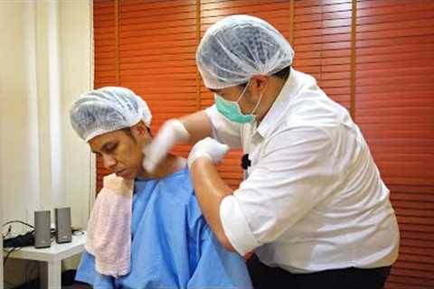 Tuina Massage TRADITIONAL CHINESE MEDICAL Treatment for Back &amp; Shoulder Pain Relief
