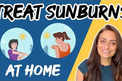 Natural Treatment for Sunburns at Home |  Sunburn Causes &amp; Treatment | Dr. Aanchal