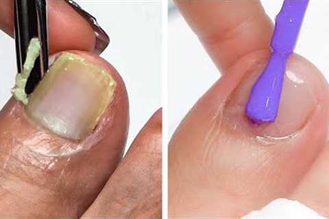 #522 15+ Nail Art Compilation | Trending Nail Art Designs for 2022