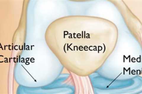 Knee Update - Mixed News