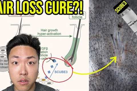 DID WE FIND A HAIR LOSS CURE WITH SCUBE3? **UNLIMITED HAIR GROWTH POTENTIAL**
