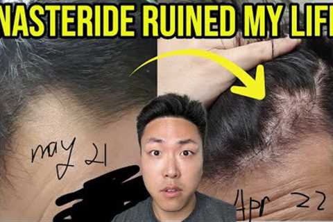 FINASTERIDE RUINED MY LIFE AND HAIR...