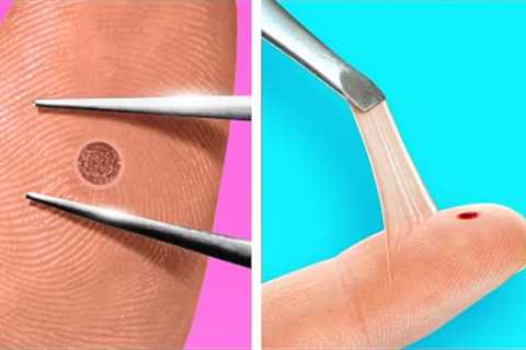 FIRST AID HACKS | Safety Tricks, New Gadgets and Appliances For Unlucky Situations!