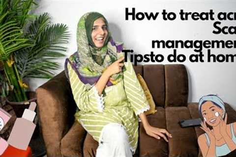 how to treat acne &amp; pimples at home / easy tips to follow