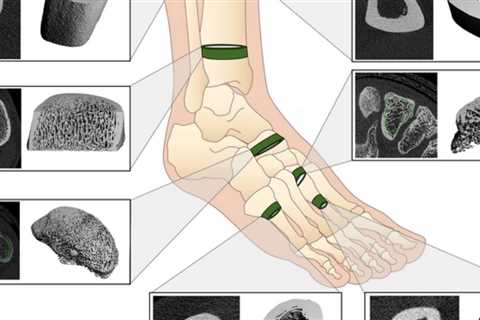Soccer and basketball are better than running for young athletes' bones.