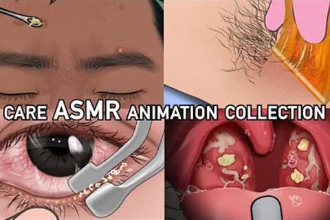 ASMR care animation collection/Pimple Skin Care/Waxing/Eyelid Sebum/tonsillitis &amp; tonsil stone