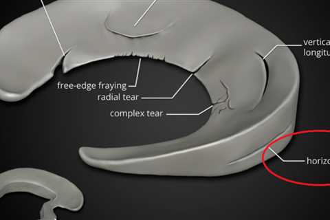 Knee Follow-up