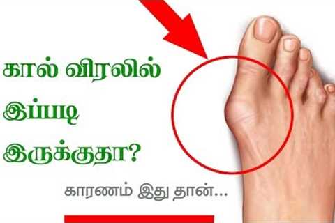 Home Remedies for Rheumatoid Arthritis - Tamil Health Tips
