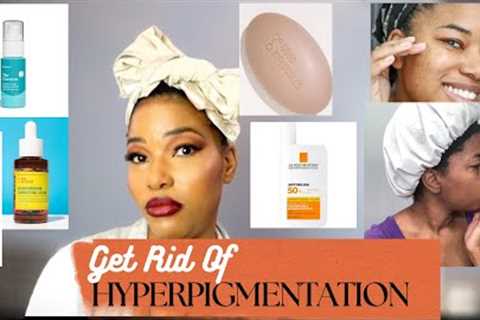 How To Get Rid of Hyperpigmentation | Tips for Acne Scars and Hyperpigmentation | Sandy Esprit