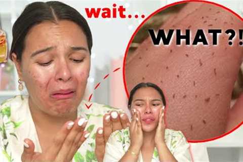 I TRIED OIL CLEANSING AND THIS HAPPENED…😳Uhhh...