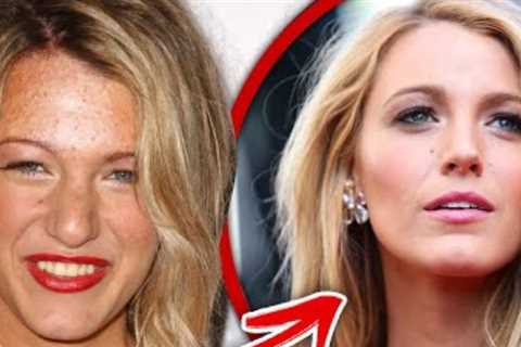 Top 10 Celebrities Who Have Had MAJOR Glow Ups