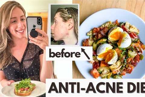 Anti-Acne Diet: What I Eat in a Day for Hormonal Acne