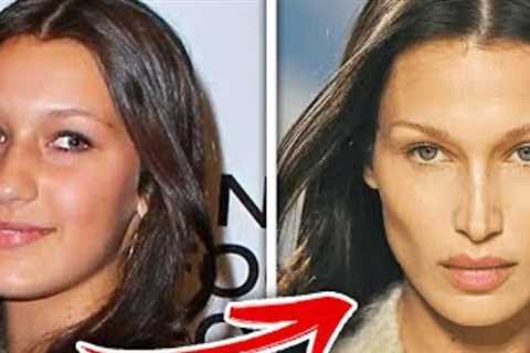 The Top 10 Celebrities Who Refused Plastic Surgery