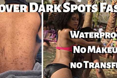 How To Get Rid of Dark Spots FAST | Cover Dark Spots WITHOUT makeup