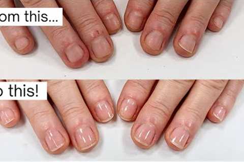 How did she stop biting &amp; picking her nails? [week by week progress]