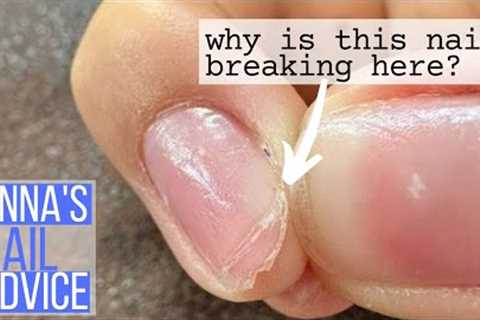 Why is this nail breaking here?!  [Anna's Nail Advice]