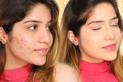 HIDE Acne / Pimples / Scars With MAKEUP