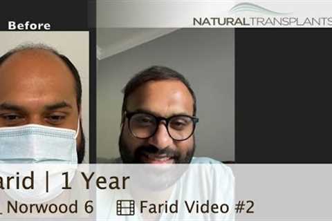 Hair Transplantation Surgery - He Got His Hair Back 1 Year Later | Dr. Blumenthal (Farid)