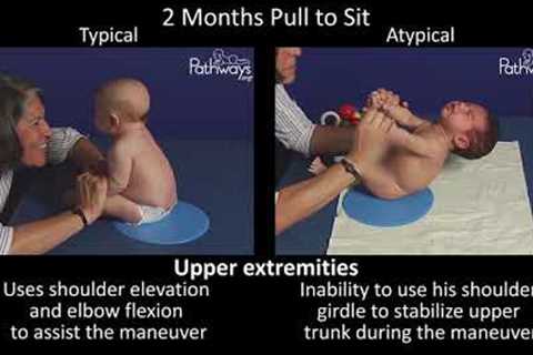 2 Month Old Baby Typical &amp; Atypical Development Side by Side