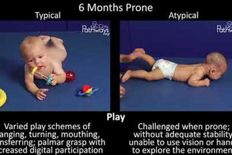6 Month Old Baby Typical &amp; Atypical Development Side by Side