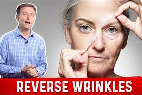 How To Reverse Wrinkles ? – Dr.Berg on Anti Aging Hormones