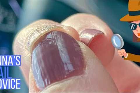 Why You Shouldn't Buff Nail Ridges.  [Anna's Nail Advice] 🕵️‍♂️