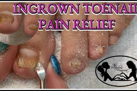👣 Satisfying Ingrown Toenail Pain Pedicure Tutorial👣