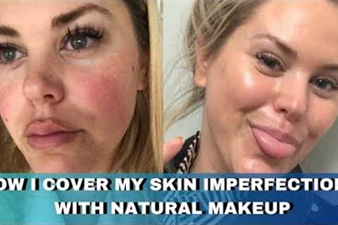 How I Cover My Skin Imperfections with Makeup that looks Natural  / Acne, Melasma, Rosacea, Scarring