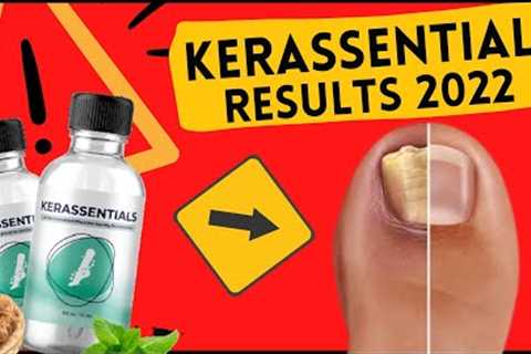 KERASSENTIALS REVIEW ⚠️( WARNING )⚠️ Nail Fungus Treatment Oil - KERASSENTIALS Honest Reviews 2022