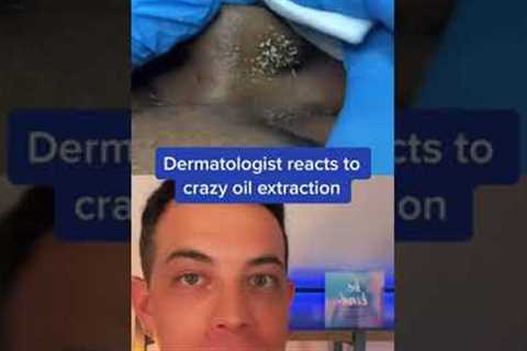 So much oil from this nose! | 208SkinDoc