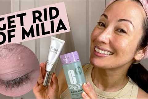 Get Rid of Milia With This Nighttime Skincare Routine (Removal &amp; Treatment Tips) | Susan Yara
