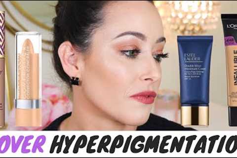 THE BEST MAKEUP TO COVER HYPERPIGMENTATION, MELASMA, DARK SPOTS &amp; SKIN IMPERFECTIONS