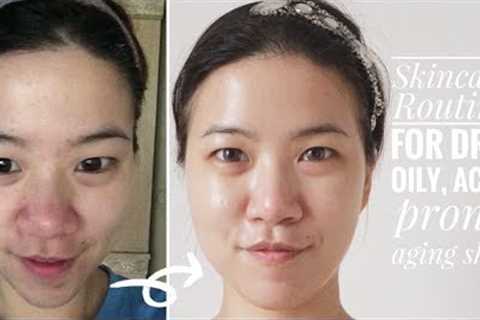 My Skincare Routine | Acne Prone, Dry, Oily &amp; Aging Skin