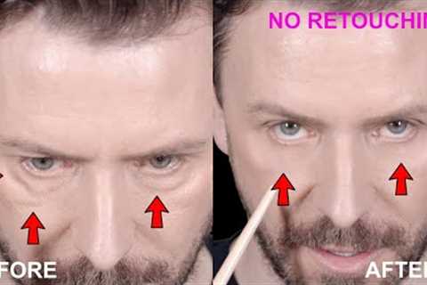 EYE BAGS. MALAR BAGS. FESTOONS. AND HOW TO COVER THEM UP INSTANTLY!