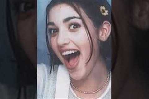 kim kardashian before surgery😳Kim kardashian surgery