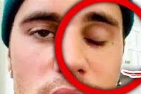 The Top 10 Celebrities That You Did Not Know had Incurable Diseases. Part 2.