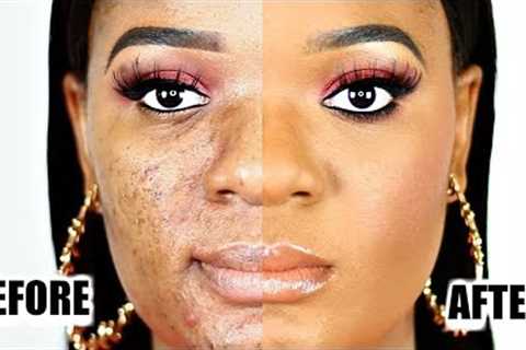 LARGE PORES? ACNE SCARS?? BUMPY SKIN??? HOW TO COVER PROBLEMATIC SKIN WITH MAKEUP | OMABELLETV
