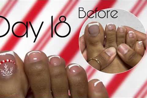 Acrylic Toe Update! Easy Christmas Nail Art Design | Nailmas